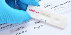 Точки бесплатного тестирования на коронавирус на Кипре 20 декабря
