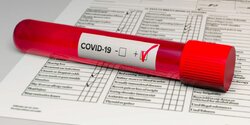 Где сдать экспресс-тест на коронавирус на Кипре 3 мая?