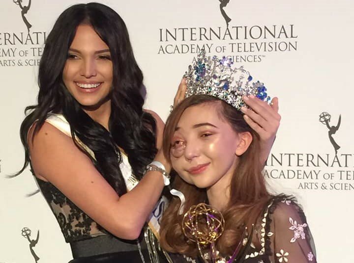 Необычная кипрская девочка получила престижную премию Emmy Kids