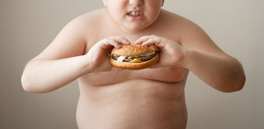 Дети на Кипре страдают от ожирения