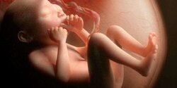 Анестезиологи Кипра отказываются делать аборты