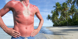 В Ларнаке на пляже мужчина получил солнечный алкоудар