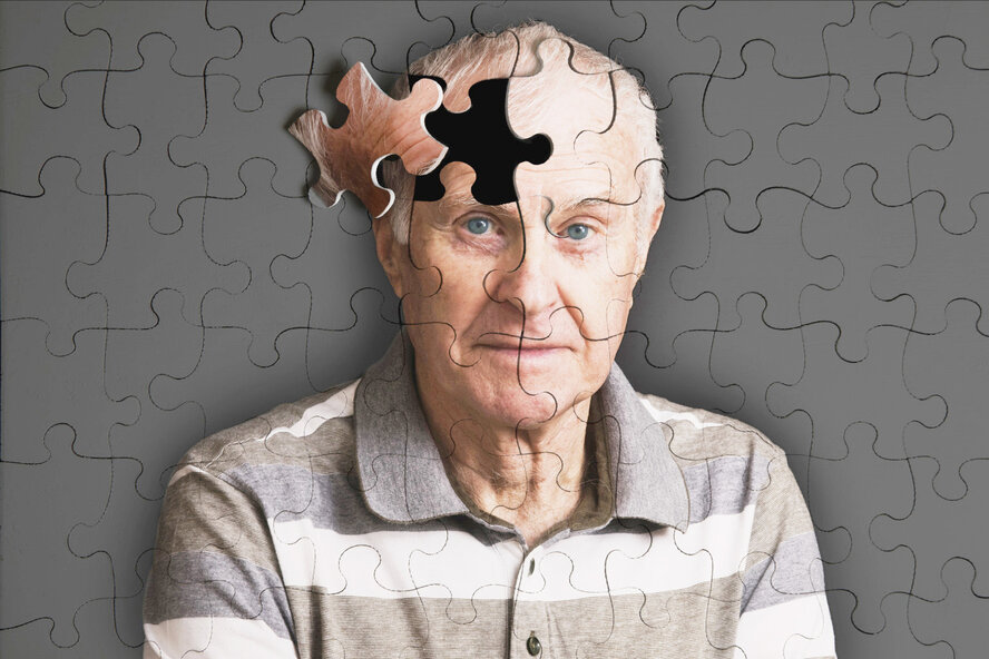 У каждого девятого человека старше 65 лет развивается болезнь Альцгеймера