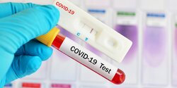 Где пройти тестирование на коронавирус на Кипре 15 марта?