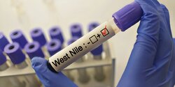 4 человека на Кипре заразились вирусом Западного Нила