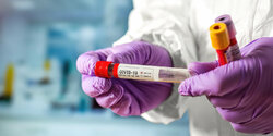 Точки бесплатного тестирования на коронавирус на Кипре 15 декабря