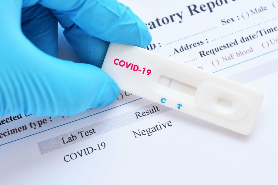 Точки бесплатного тестирования на коронавирус на Кипре 20 декабря