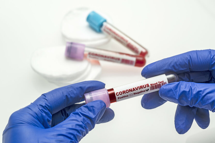 На Кипре обновился список лабораторий для тестирования на коронавирус