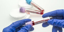 На Кипре обновился список лабораторий для тестирования на коронавирус 