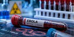 Стоит ли бояться лихорадку Эбола на Кипре?