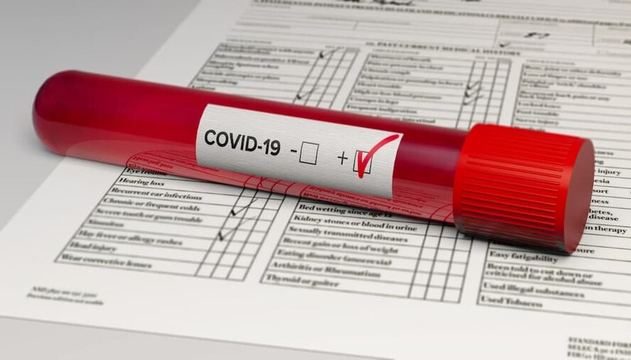 Точки бесплатного тестирования на коронавирус на Кипре от 2 февраля