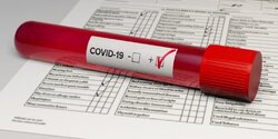 Точки бесплатного тестирования на коронавирус на Кипре от 2 февраля
