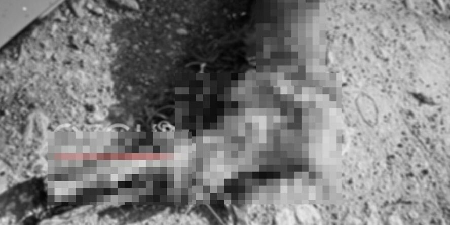 На северном Кипре в мусорном пакете нашли отрубленную человеческую ногу