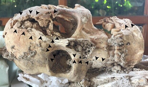 Археологи установили причину смерти человека, умершего в Курионе 1600 лет назад