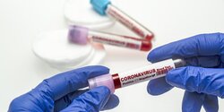 Стали известны точки бесплатного тестирования на коронавирус на Кипре