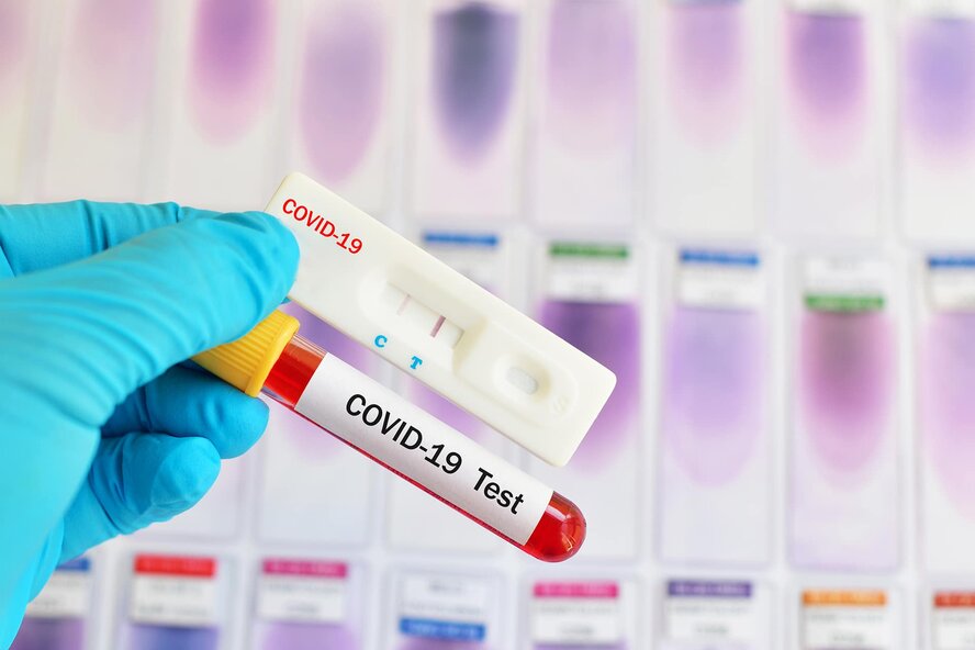 Точки бесплатного тестирования на коронавирус на Кипре от 22 января