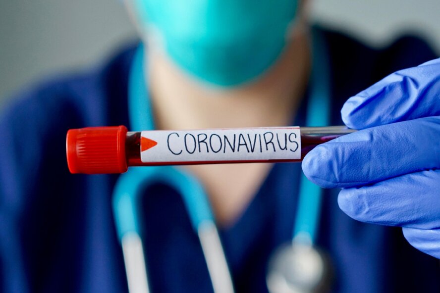 Точки бесплатного тестирования на коронавирус на Кипре 28 мая