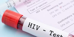 На Кипре на 26% сократилось число случаев ВИЧ
