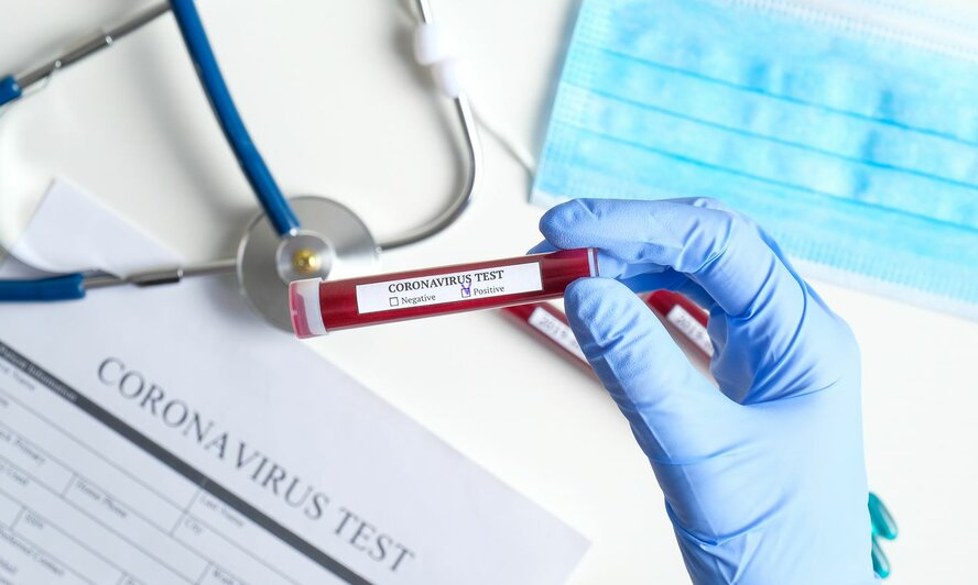 У 34-х человек в ТРСК экспресс-тесты на коронавирус оказались положительными