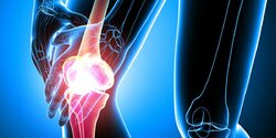 Ученые из университета Кипра выяснили, что помогает при профилактике остеоартрита 