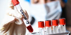 Где сдать экспресс-тест на коронавирус на Кипре 7 мая?