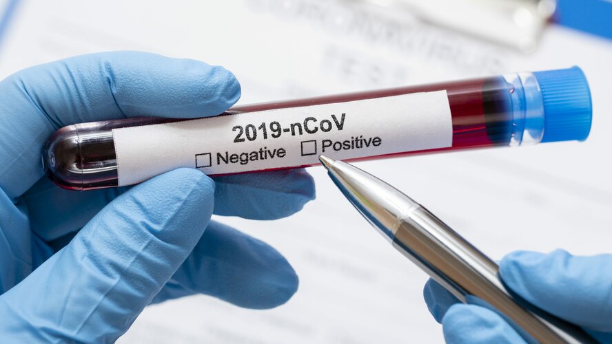Точки бесплатного тестирования на коронавирус на Кипре 10 мая