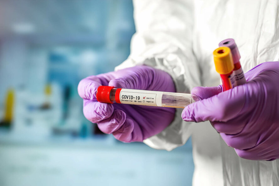 Точки бесплатного тестирования на коронавирус на Кипре 28 декабря