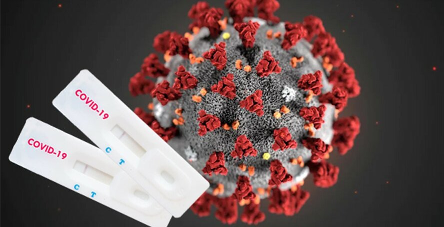 Точки бесплатного тестирования на коронавирус на Кипре 30 декабря