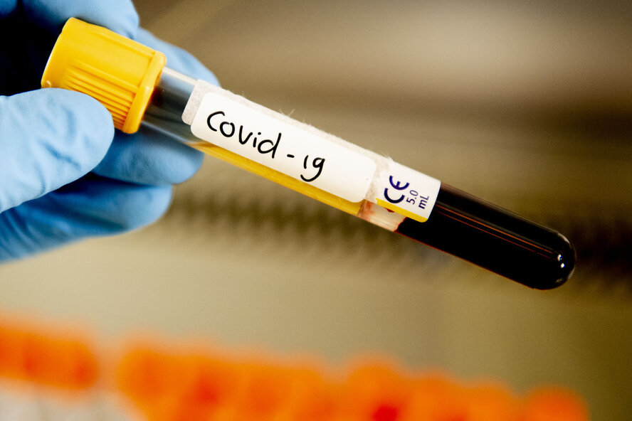 Точки бесплатного тестирования на коронавирус на Кипре 21 мая
