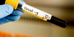 Точки бесплатного тестирования на коронавирус на Кипре 21 мая