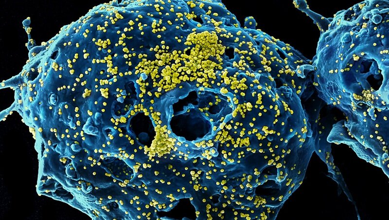 Появилась карта, которая показывает распространение коронавируса в реальном времени