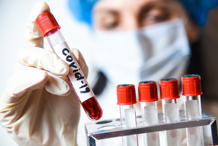 Точки бесплатного тестирования на коронавирус на Кипре