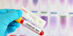 Точки бесплатного тестирования на коронавирус на Кипре 31 мая