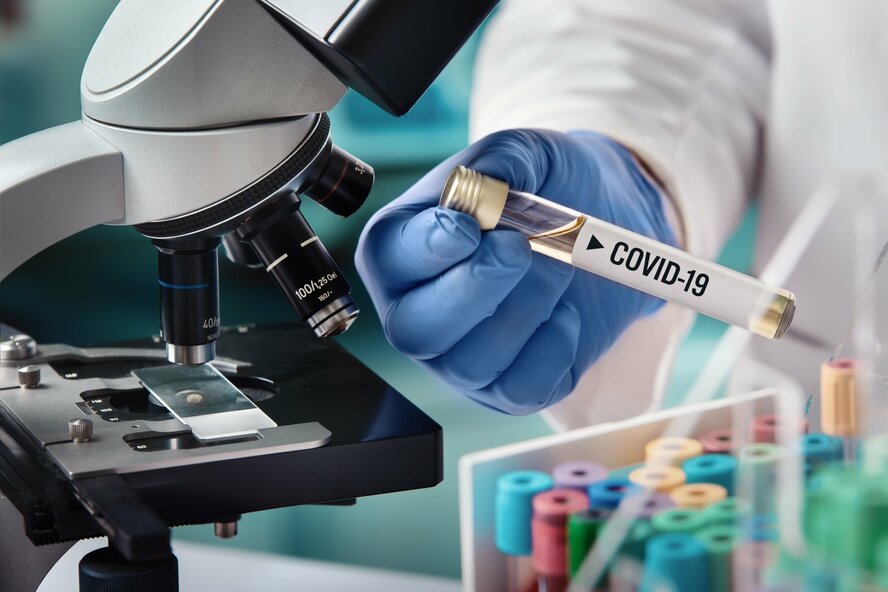 На Кипре растет число случаев заболевания Covid На Кипре растет число случаев заболевания Covid