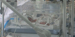 На Кипре появится новое отделение интенсивной терапии новорожденных