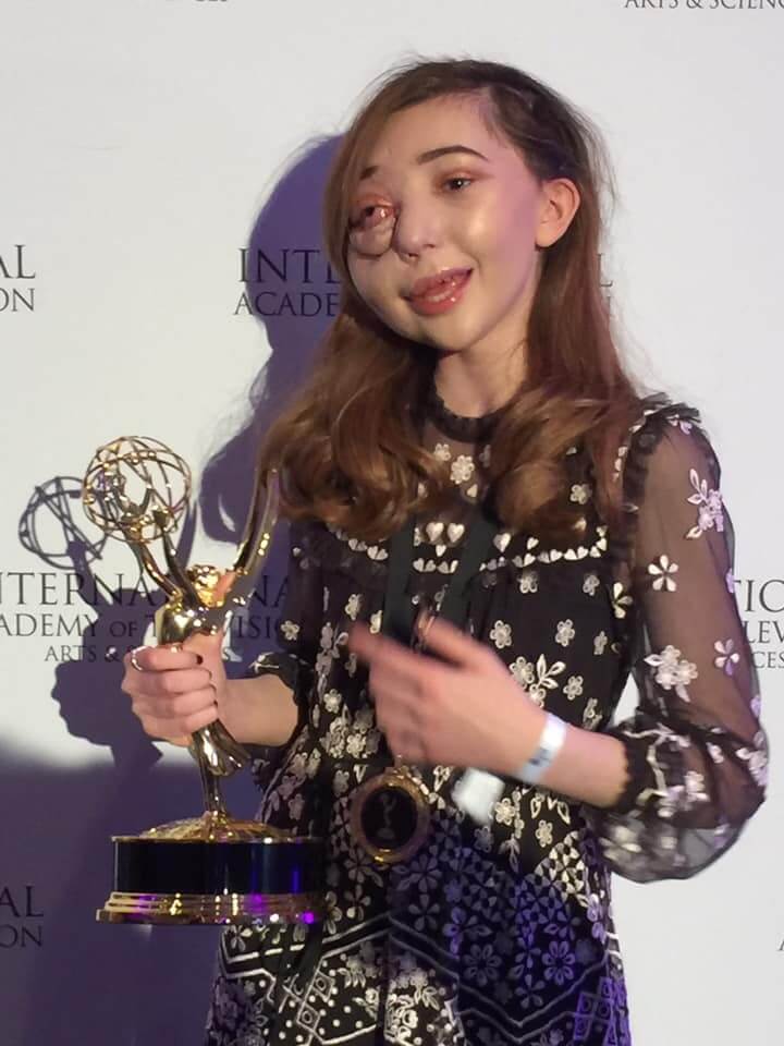 Необычная кипрская девочка получила престижную премию Emmy Kids: фото 4