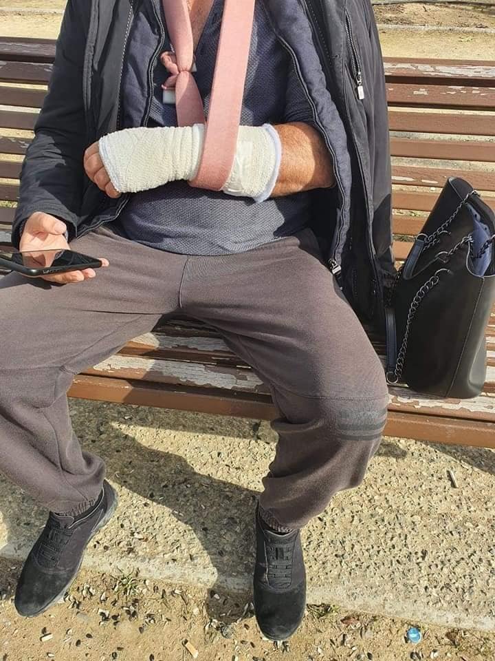 В сети появились жесткие кадры травм людей, пострадавших во время протестов в Никосии: фото 2