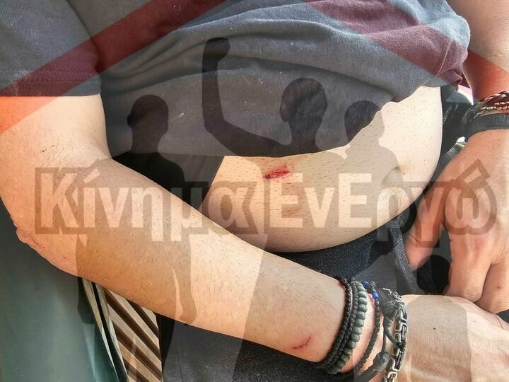 В Лимассоле сотрудник полиции получил "легкий" удар ножом в живот: фото 2