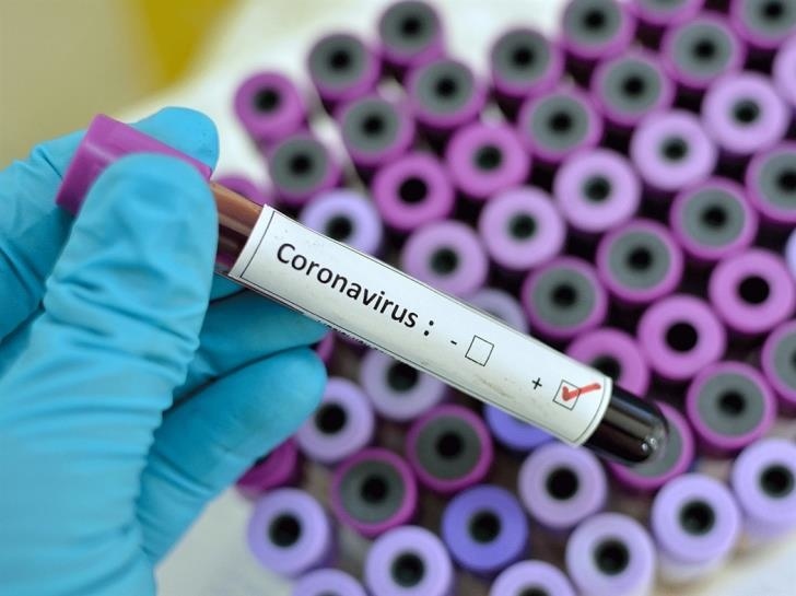Общее число заболевших коронавирусом на Кипре достигло 11 человек: фото 2