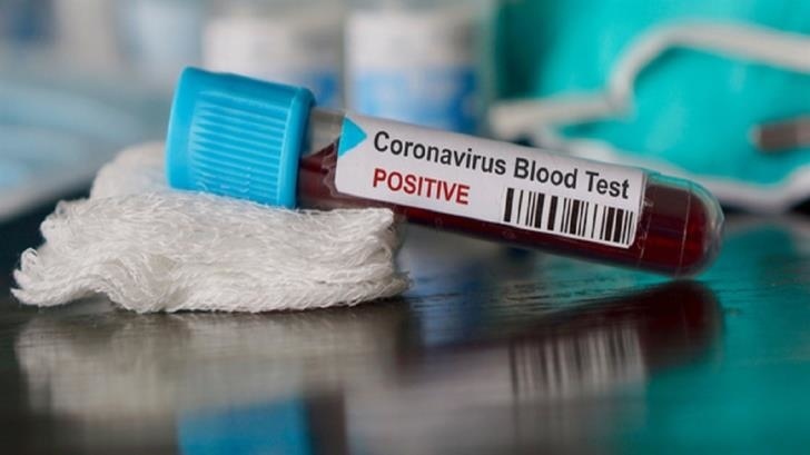 Общее число заболевших коронавирусом на Кипре достигло 46 человек: фото 2