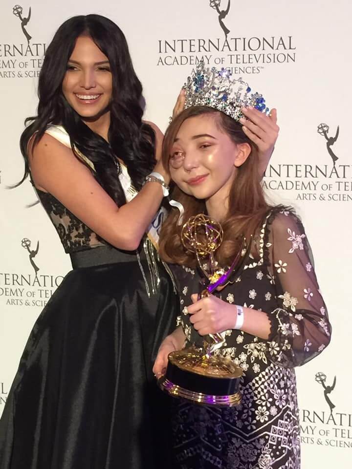 Необычная кипрская девочка получила престижную премию Emmy Kids: фото 3