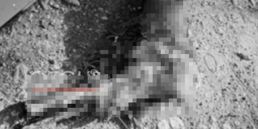 На северном Кипре в мусорном пакете нашли отрубленную человеческую ногу: фото 2