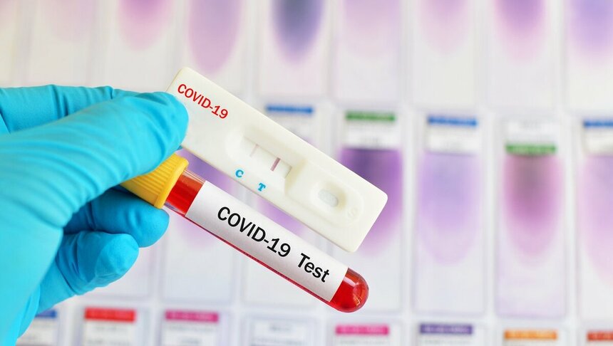 Точки бесплатного тестирования на коронавирус на Кипре 1 марта: фото 2