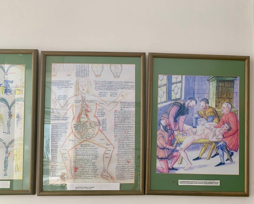 Медицинский музей в Ларнаке показывает, как лечили более ста лет назад: фото 6